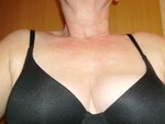 Hals-Brustbereich nach den Duschen.jpg