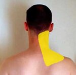 Levator-Scapula-Referral.jpg