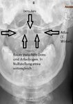 1. HWS frontal Nullstellung.jpg