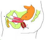 Stylized_depiction_of_action_of_puborectalis_sling.jpg