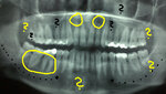 ewigerOptimist2017-03-09_09-34-13_805b.jpg