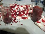Biofilm in Leber aufgebrochen - 3 Liter Blutverlust.jpg