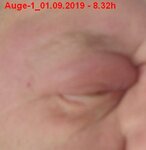 Auge-1_01.09.2019 - 8.32h.jpg