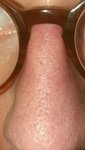 Nase.jpeg Nase.jpeg