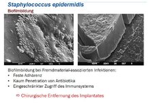 Staphylokokken-Teil-06.jpg Staphylokokken-Teil-06.jpg