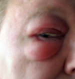 Schießen Auge-1.jpg