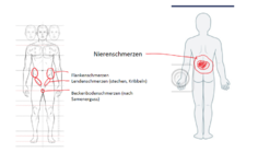 Schmerzen-Nieren.png