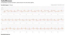 ekg-16-09B-krankenhaus.jpg