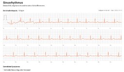 ekg-31-10.jpg