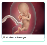 Unbenannt1.PNG Unbenannt1.PNG