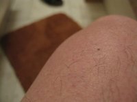 knie-links.jpg
