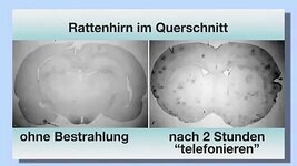 vlcsnap-00001-Gehirn nach 2 Std. Bestrahlung.jpg