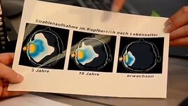 vlcsnap-00008 Betrahlung des Gehirns beim Telefonieren.jpg