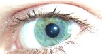 Auge 009.JPG